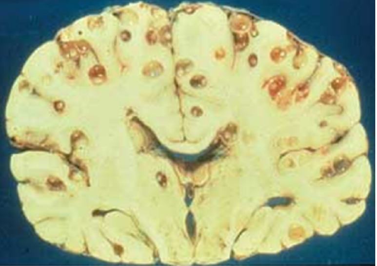 <p>what specie can infect the brain, Order</p>