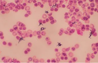 <p>what organism is this</p>