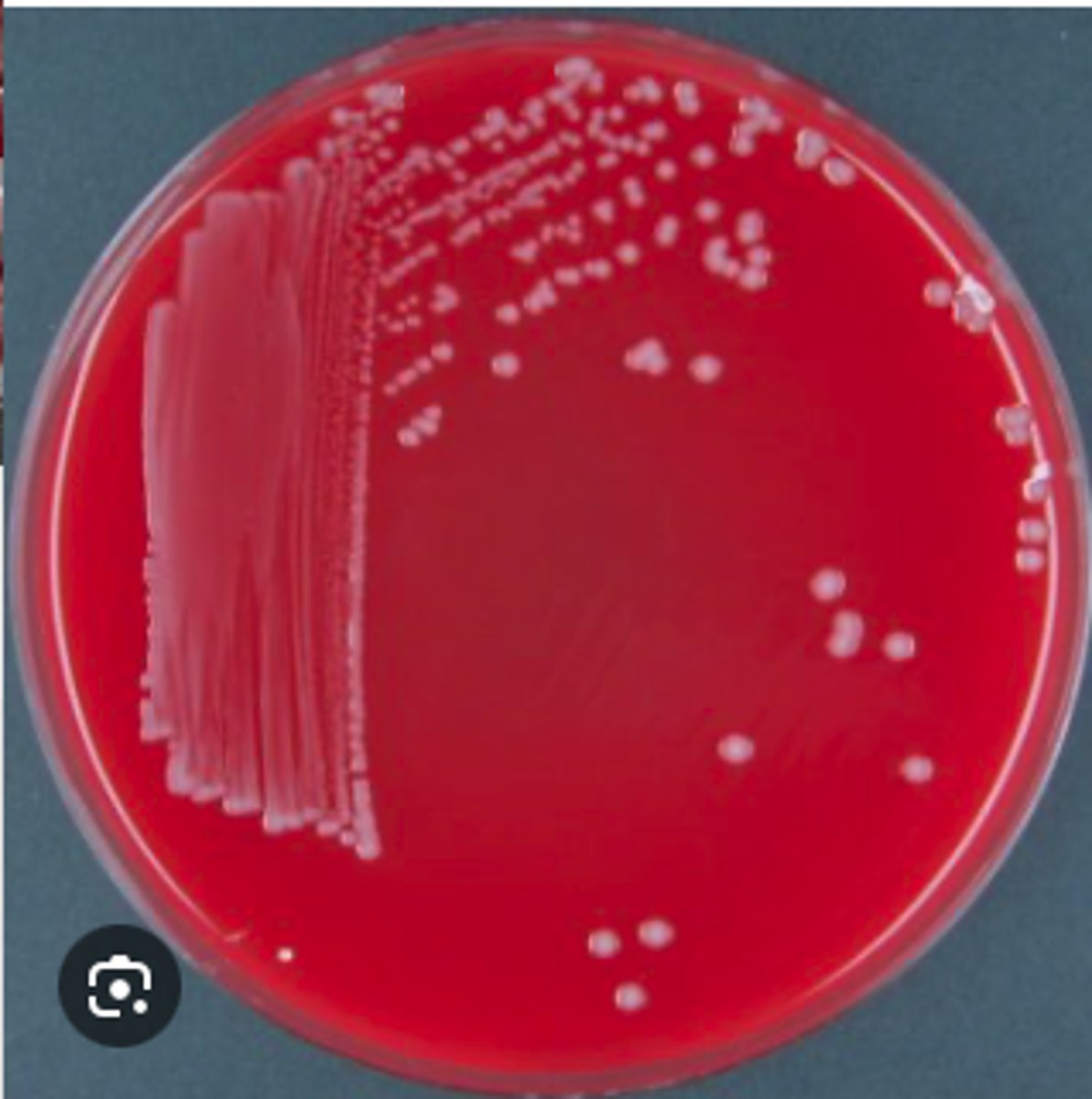 <p>A young adult male cat was presented for clinical examination with a recent history of lethargy, inappetence, fever, and dyspnea. The cat also has a wound infection on his chest from a suspected cat fight a week ago. You are provided with a swab of the purulent exudate aspirated from the cat’s pleural cavity.</p><p>Tests: </p><p>Gram negative coccobacilli with bipolar staining</p><p>Non-hemolytic </p><p>Presumptive Diagnosis </p>