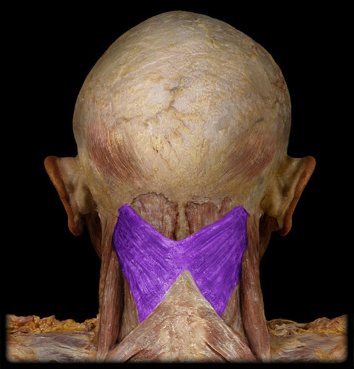 <p>attaches to mastoid process</p>