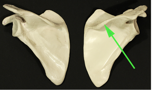 <p>Name the part of the scapula indicated by the green arrow.</p>