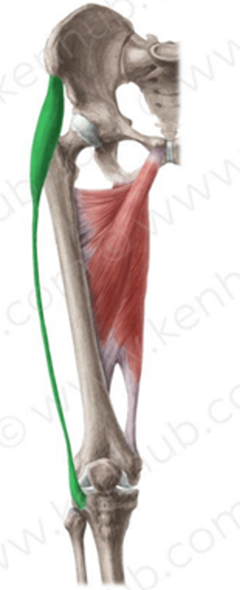 <p>Iliac crest, posterior to the anterior superior iliac spine (ASIS)</p>