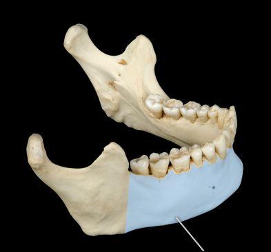 <p><span>What portion of the Mandible is this highlighted in blue?</span></p>