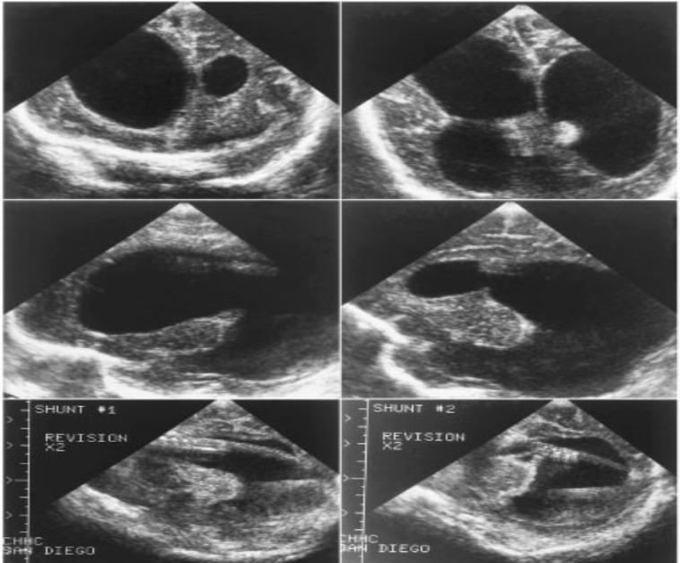 <p>What is this imaging showing?</p>
