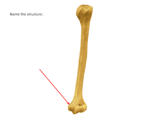 <p>Name the structure</p>