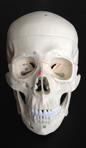 <p>Identify the bone.</p>