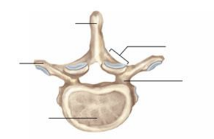 <p>what vertebrae type is this ?</p>