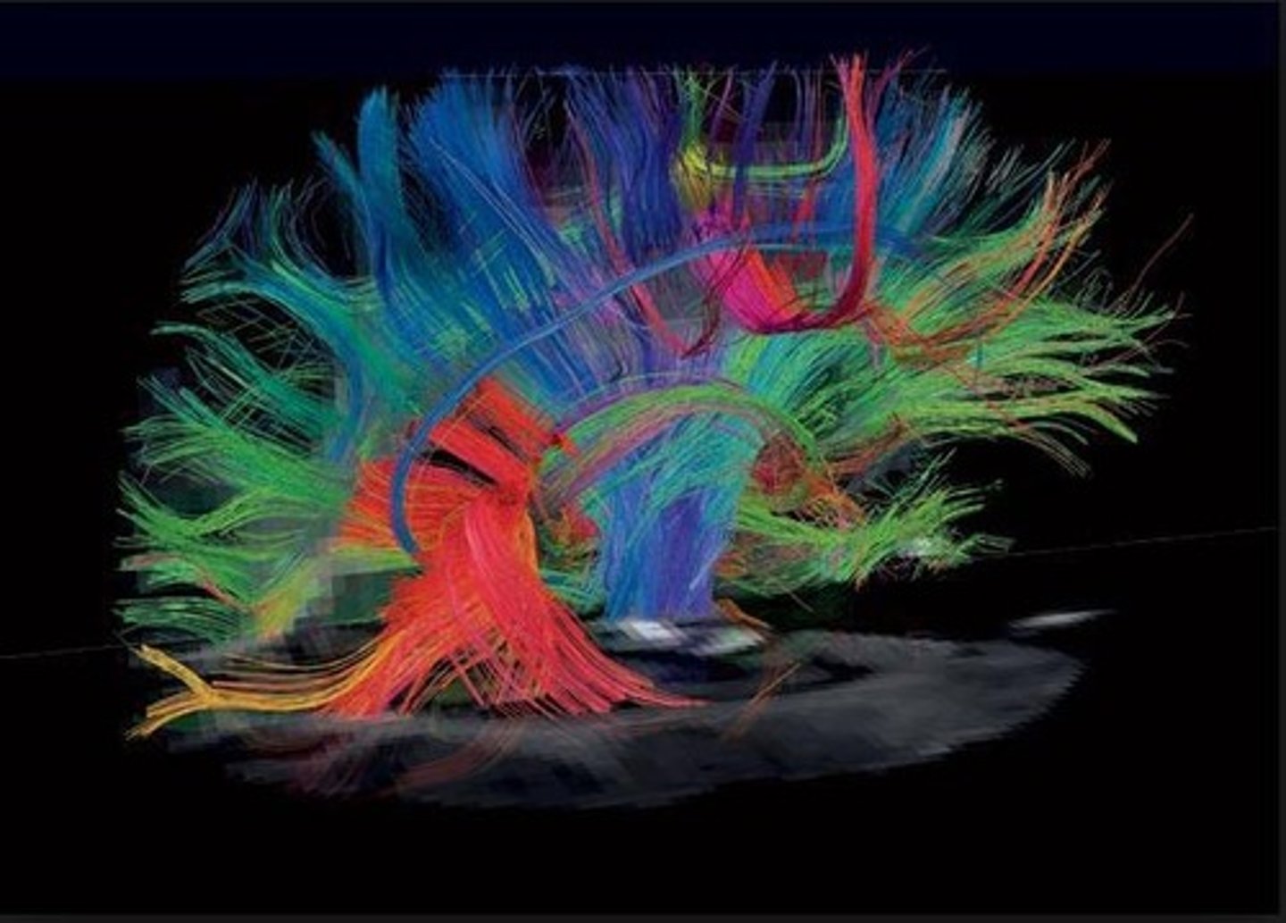 <p>The movement of water molecules along nerve cell connections, revealing the brain's pathways.</p>