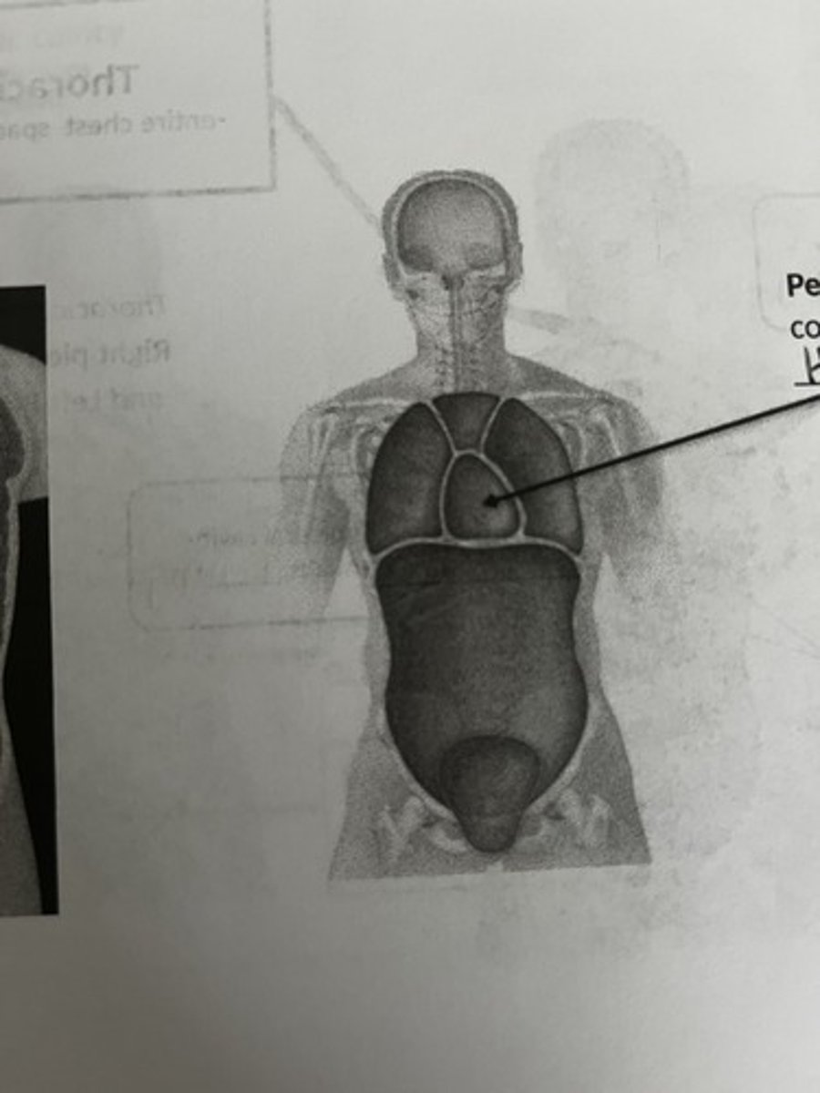 <p>What cavity does this picture represent?</p>