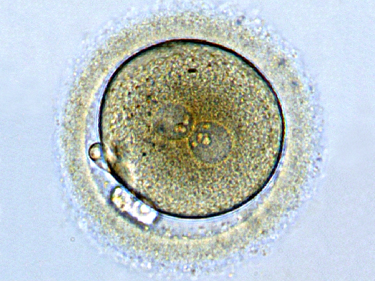 <p>Zygote</p>