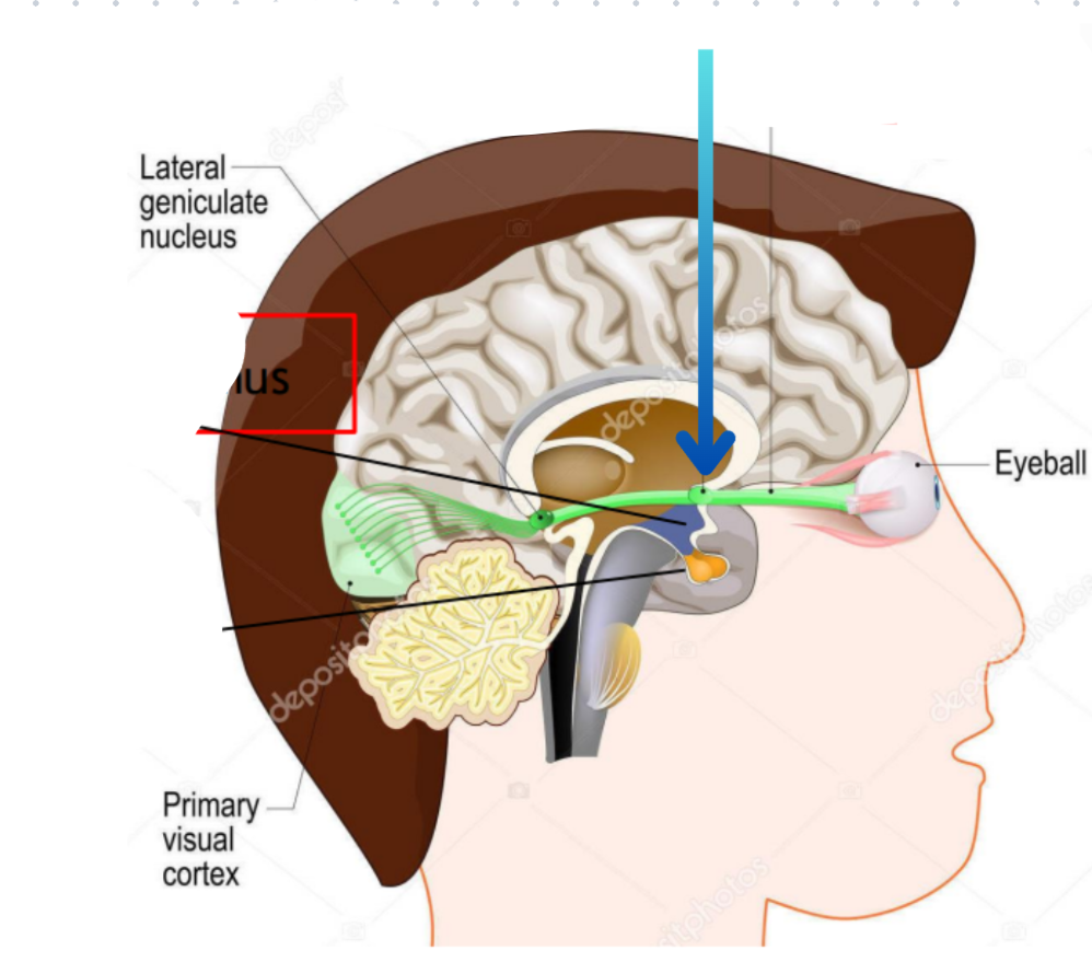 term image
