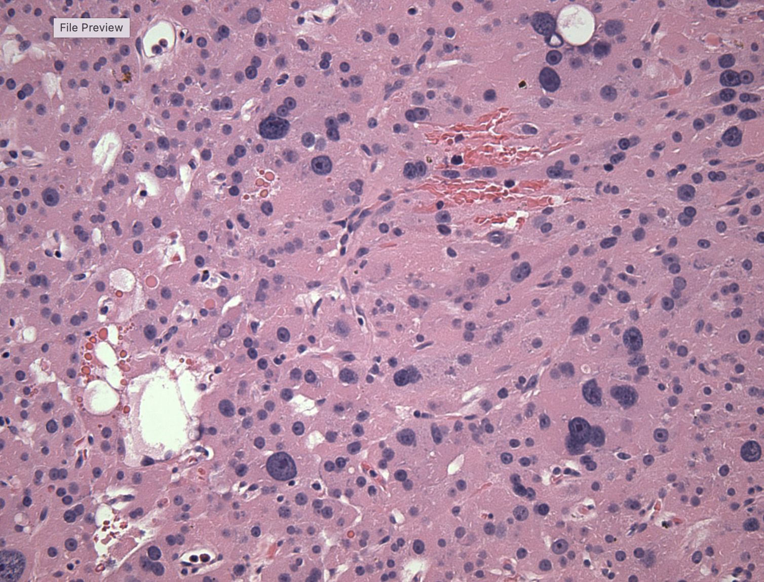 term image