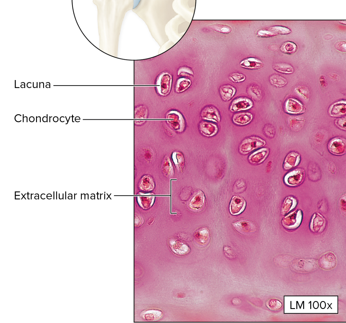 <p>What type of Cartilage Connective Tissue is this?</p>