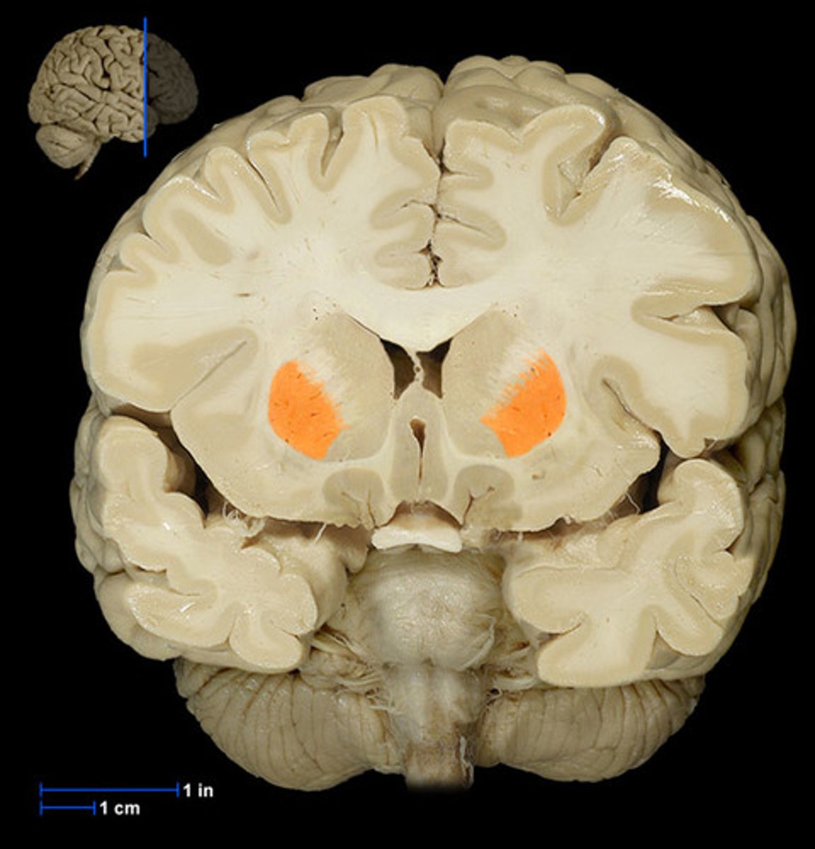 <p>Part of the basal ganglia that helps regulate movement.</p>