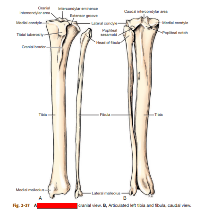 <p>Which tibia and fibula is this? </p>