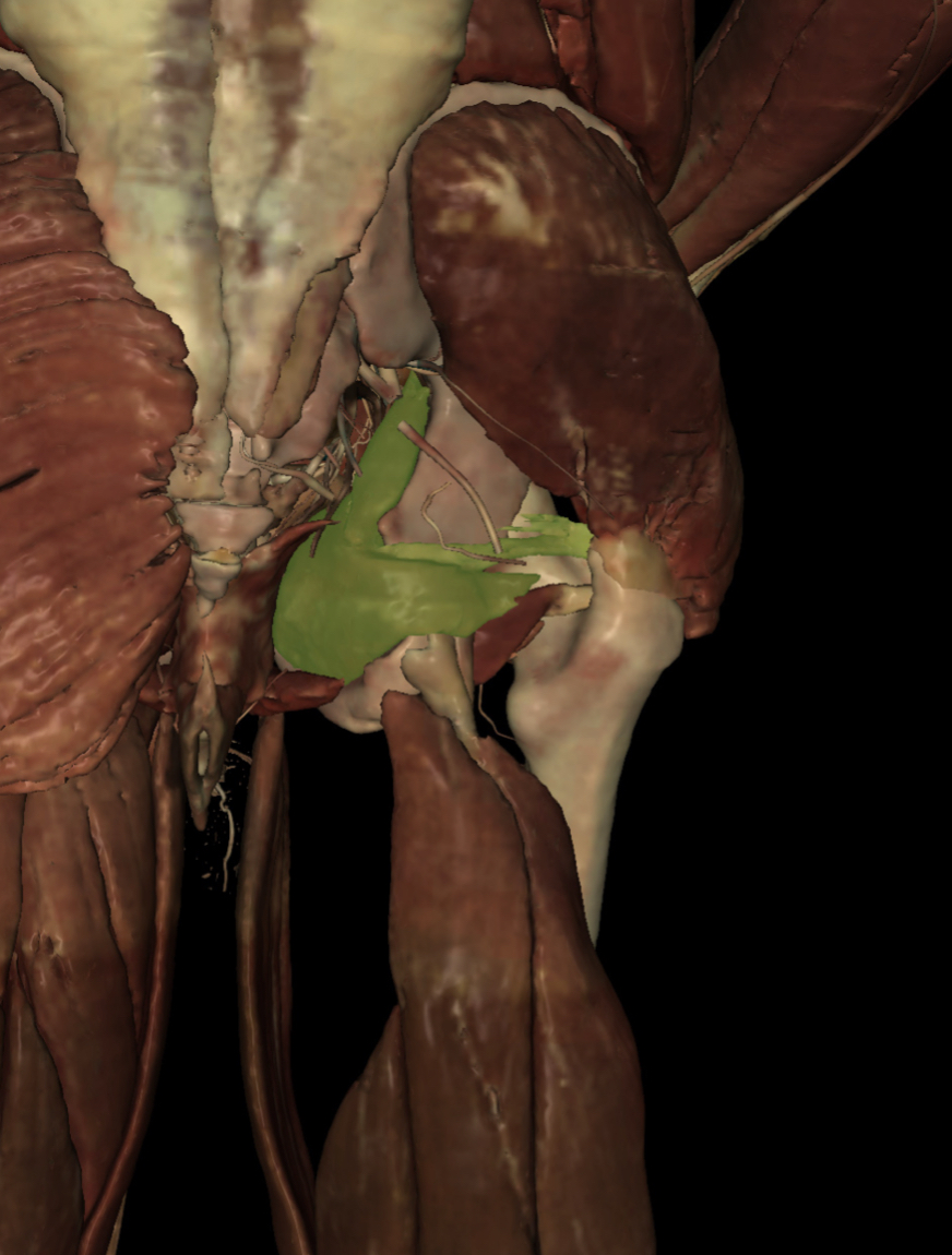 <p>Identify the Structure</p>