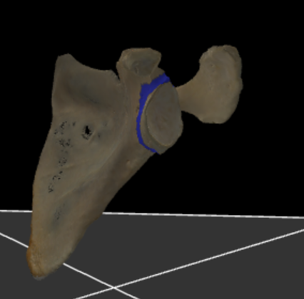 <p>deel die de cavitas glenoidalis verbindt met de rest van de scapula</p>