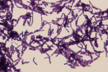 <p>what type of bacteria is this?</p>