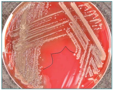 <ul><li><p>Concentric rings formed by flagellar motility</p></li><li><p>Enhanced black edges for contrast</p></li><li><p>Associated with rapid movement across agar</p></li><li><p>fx.: <em>Proteus</em> species</p></li></ul><p></p>