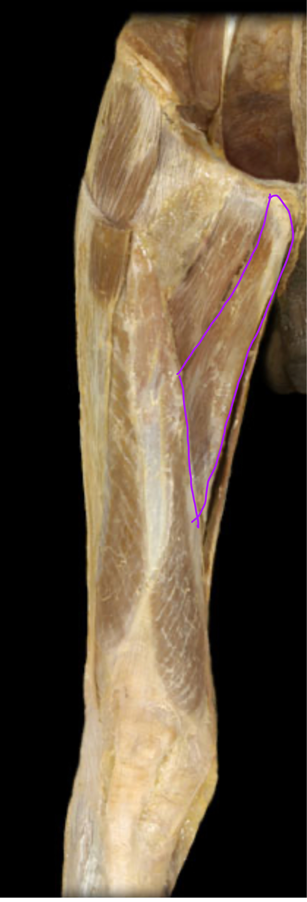<p>Innervation?</p>