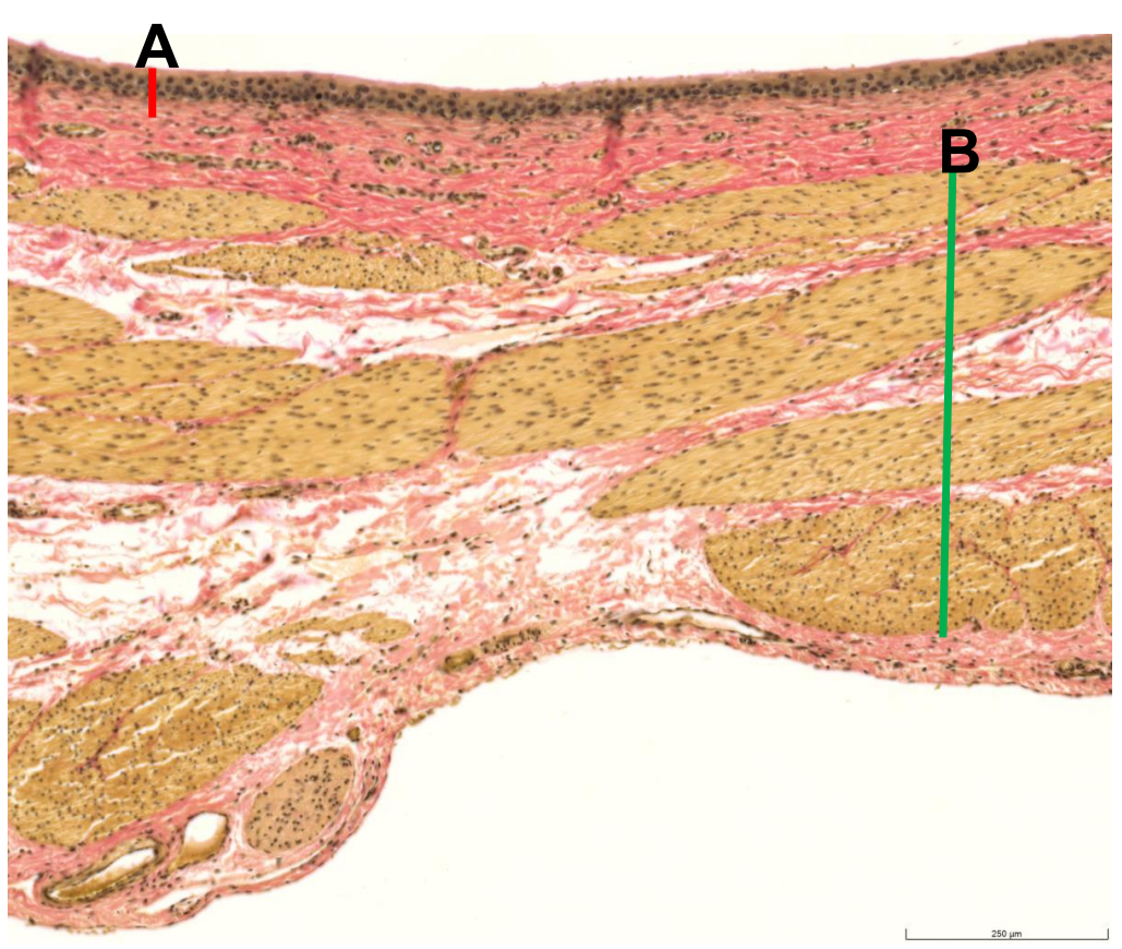 <p>Vesica urinaria</p>