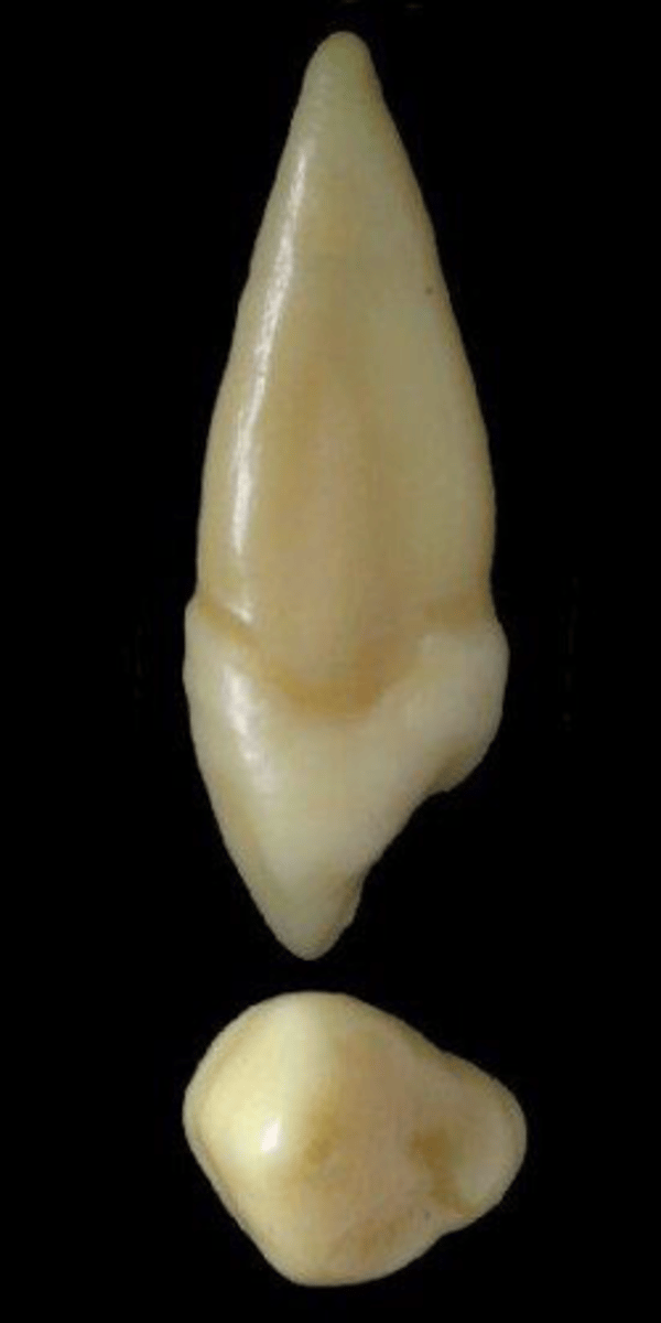 <p>what tooth is this &amp; why?</p>