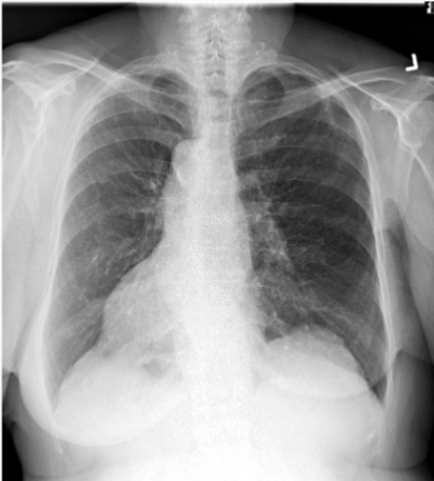 <p>What is this patient presenting with?</p>