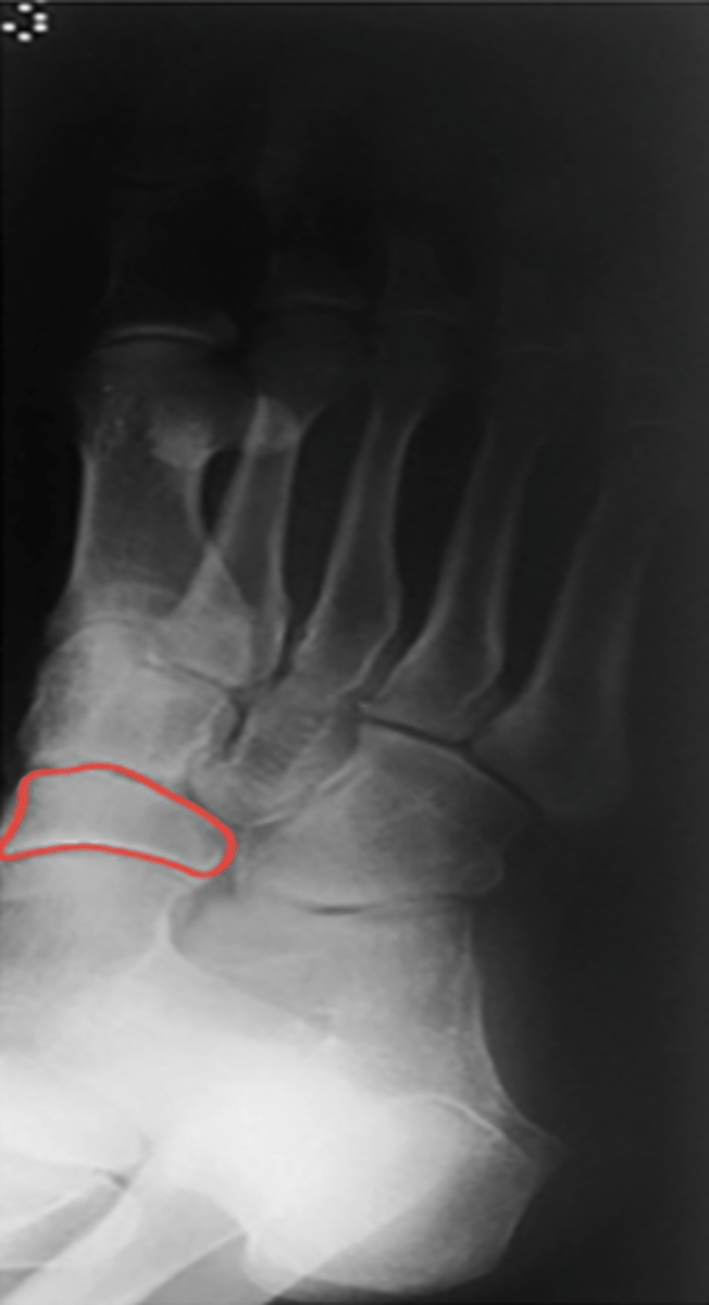 <p>What structure is highlighted?</p>