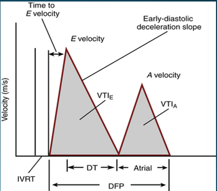 <p>time interval between aortic closure and mitral opening</p>