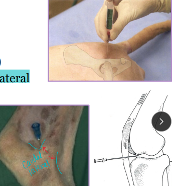 <p><span style="background-color: transparent;"><strong>Arthrocentesis</strong></span></p>