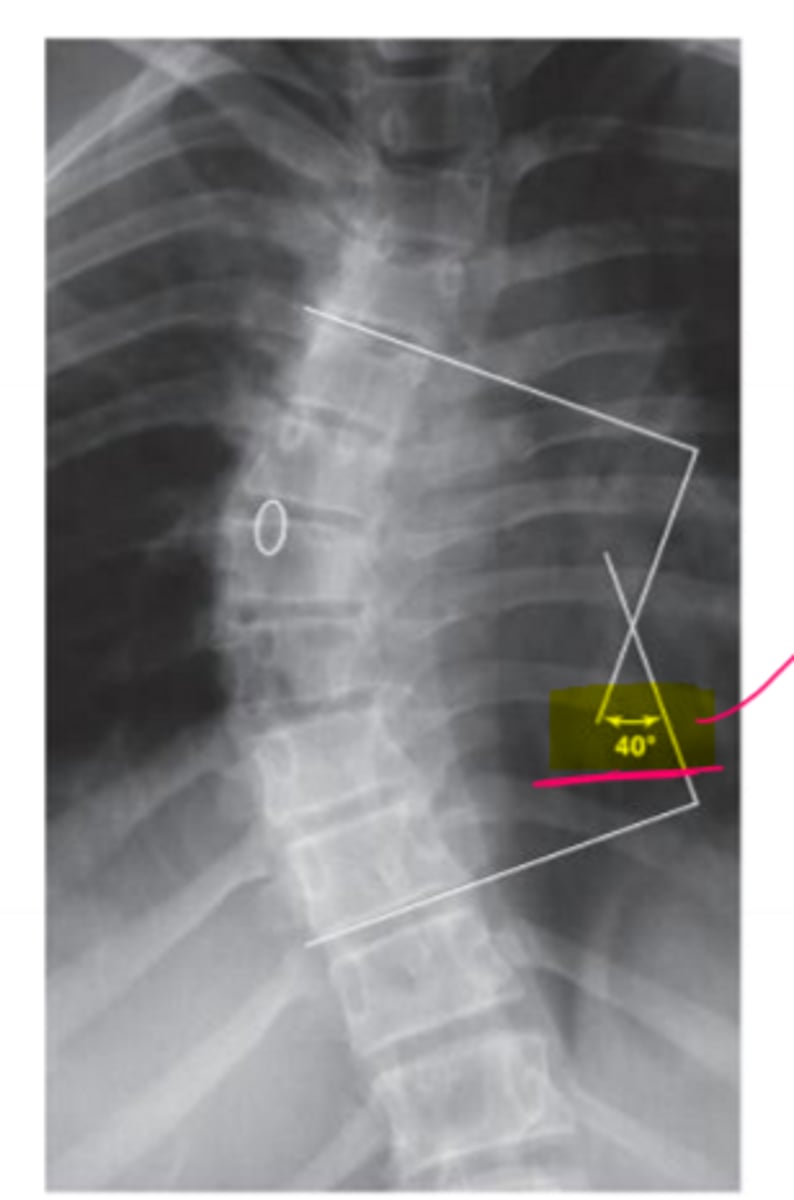 <p>What is this radiograph showing?</p>