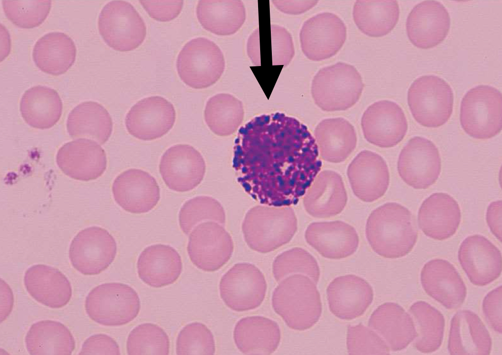 <p>What kind of blood cell is this?</p>