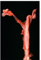 <p>What is this condition? Describe it.</p>
