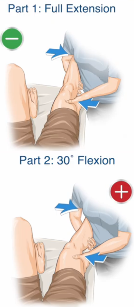 <ol><li><p>Kläm fast patientens underben mellan din arm och midja</p></li><li><p>Stötta upp underbenet med din ena hand genom att hålla under vaden, ganska nära knäet</p></li><li><p>Placera din andra hand på knäets utsida</p></li><li><p>Håll benet i extenderat läge</p></li><li><p>Applicera ett valgustryck med “knä-handen” och tryck underbenet utåt med kroppen och andra handen</p></li><li><p> . Notera smärta och rörelseomfång.</p></li><li><p>Upprepa testet med knäet lätt flekterat</p></li></ol>