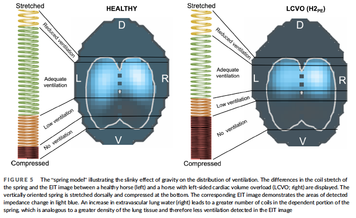 <p>Objective: To describe and compare electrical impedance tomography (EIT) variables in horses with naturally occurring compensated and decompensated left-sided cardiac volume overload (LCVO) and compare them to a healthy cohort</p><p>Results:</p><ul><li><p>Compared to the healthy horses, the LCVO cohort had significantly less ventilated left (VAL) lung area, more ventilated right (VAR) lung area, smaller avg-max VdeltaZL<sub>Line</sub> and VdeltaZL<sub>Line</sub></p></li><li><p>Ventilation was observed to be estimated lower in the ventral and central-ventral lung regions and higher in the most dorsal lung regions in the horses with clinical signs of alveolar PE than in the horses with compensated LCVO</p></li><li><p>Observation of EIT alterations were reflected by clinical signs in horses with decompensated LCVO and after administration of furosemide</p></li><li><p>Observation that the left lung was more affected by LCVO was unexpected</p><ul><li><p>in horses reversal flow might favor venous congestion and edema location in the left lung</p></li><li><p>Also may be due to the position of the heart, sitting cranio-ventrally and slightly left-sided within the thorax</p><ul><li><p>Enlarged left atrium of horses with LCVO might compress the left mainstem bronchus, restricting the airway lumen and redirecting the gas toward the right lung</p><ul><li><p>Less likely due to lack of inhomogeneity in inflation of the right and left lung units</p></li></ul></li></ul></li></ul></li><li><p>When assessing only the horses with decompensated LCVO, changes in accordance with the proposed slinky effect were observed</p><ul><li><p>Less ventilation was detected in the ventral and central-ventral ROIs and more in the most dorsal ROI when compared to horses with compensated LCVO</p></li></ul></li></ul><p>Conclusion: EIT measurements of ventilation distribution showed less ventilation in the left lung of horses with LCVO and might be useful as an objective assessment of the ventilation effects of cardiogenic pulmonary disease in horses</p>