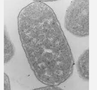 <p>Which is type of microscope is this? (E.coli under microscope) </p>