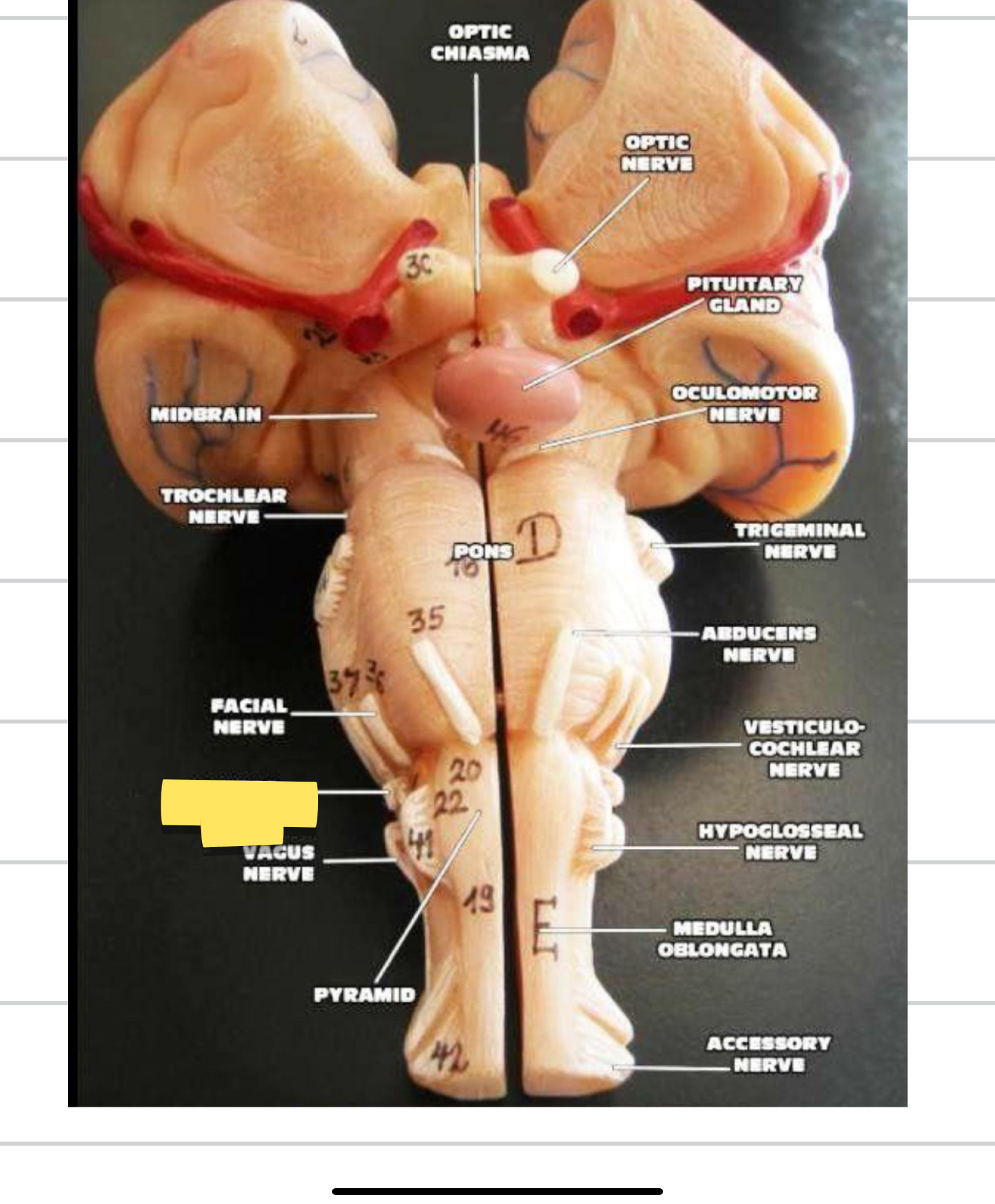 <p>Name this cranial nerve&nbsp;</p>
