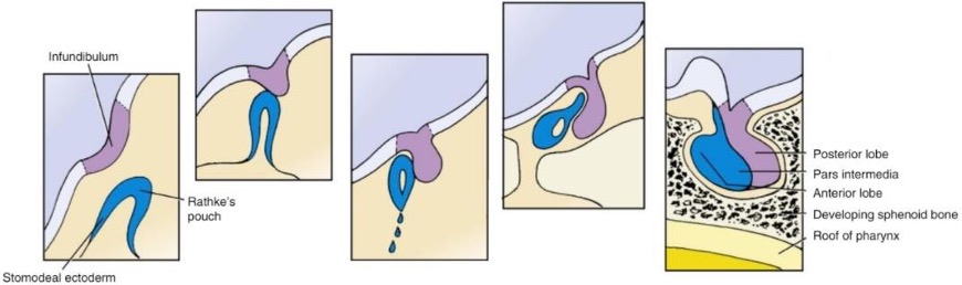 <ol><li><p>the Rathke’s pouch grows upward from the stomodeum (oral ectoderm) and the infundibulum grows as invagination of diencephalon</p></li><li><p>they meet</p></li><li><p>Rathke’s pouch loses its connection to the stomodeum and starts forming around the infundibulum</p></li><li><p>they fuse together to form the hypohysis (Rathkes pouch forms anterior, and infundibulum posterior)</p></li></ol><p></p>