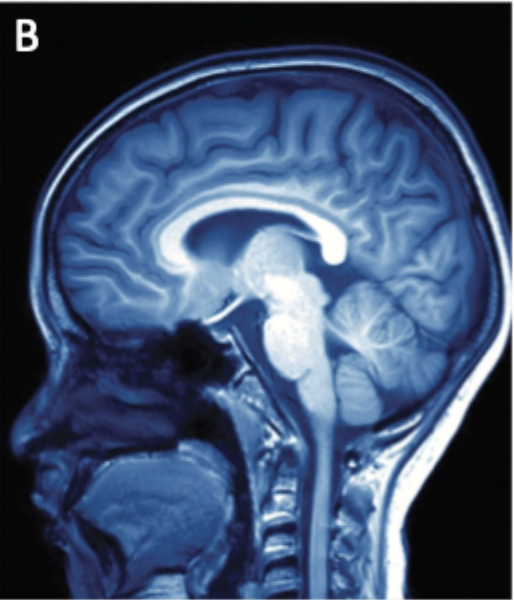 <p>Magnetic fields and radio waves to map tissue density, best for high resolution images</p>
