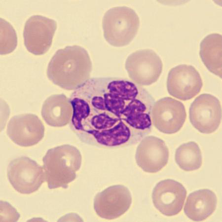 <p>What is this neutrophil showing?</p>