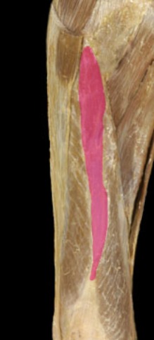 <p>deep to rectus femoris, white CT on in-class model</p>