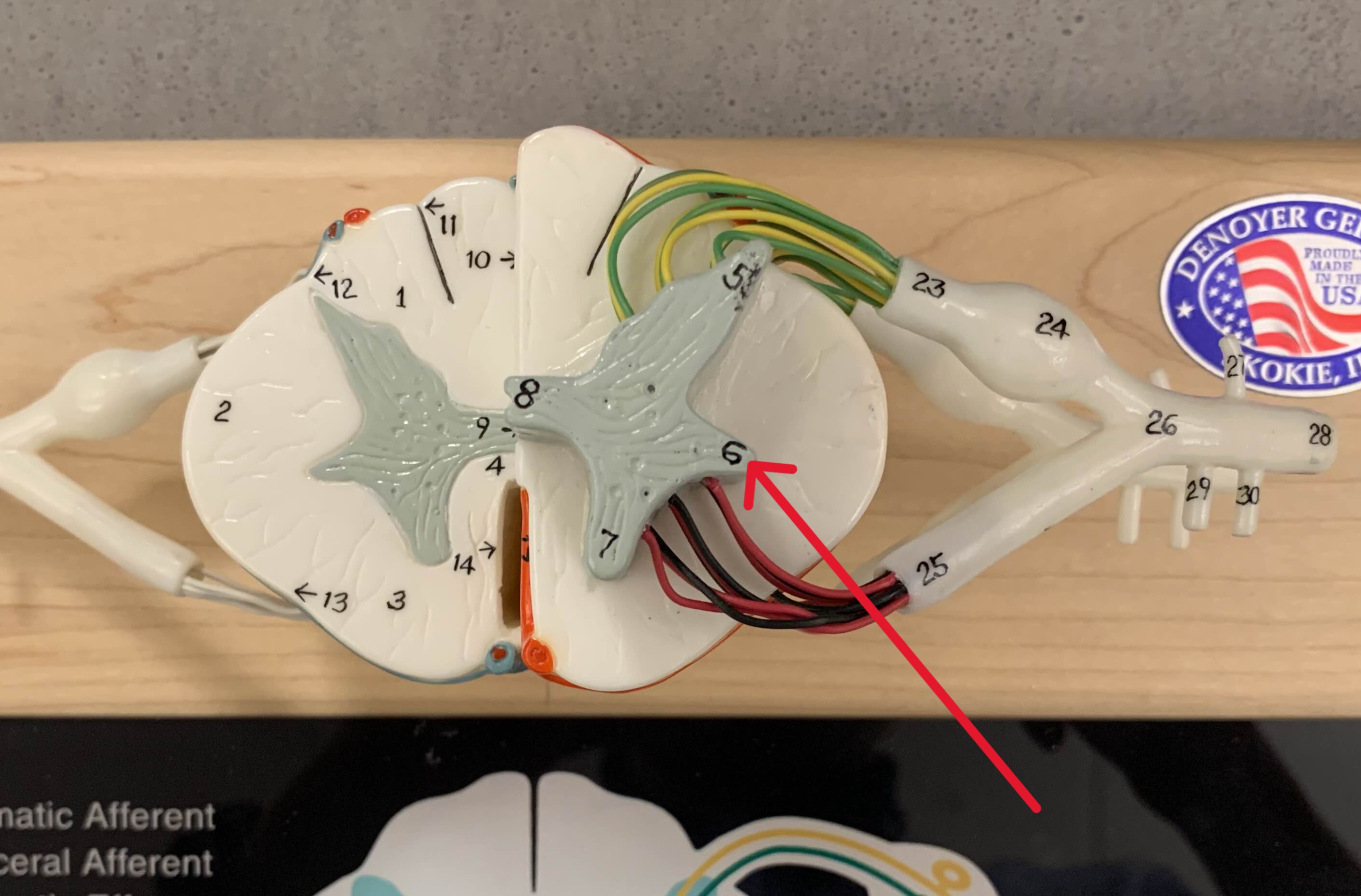<p>Which gray horn of the spinal cord is:</p><ul><li><p>Gray and on lateral side</p></li><li><p>Contain visceral motor nuclei</p></li></ul><p></p>