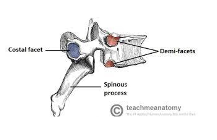 <p>What type of vertebrae is this?</p>