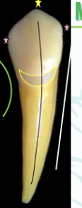 <p><mark data-color="#ffc1ec" style="background-color: #ffc1ec; color: inherit">mandibular canines #22 and #27; contact</mark></p>