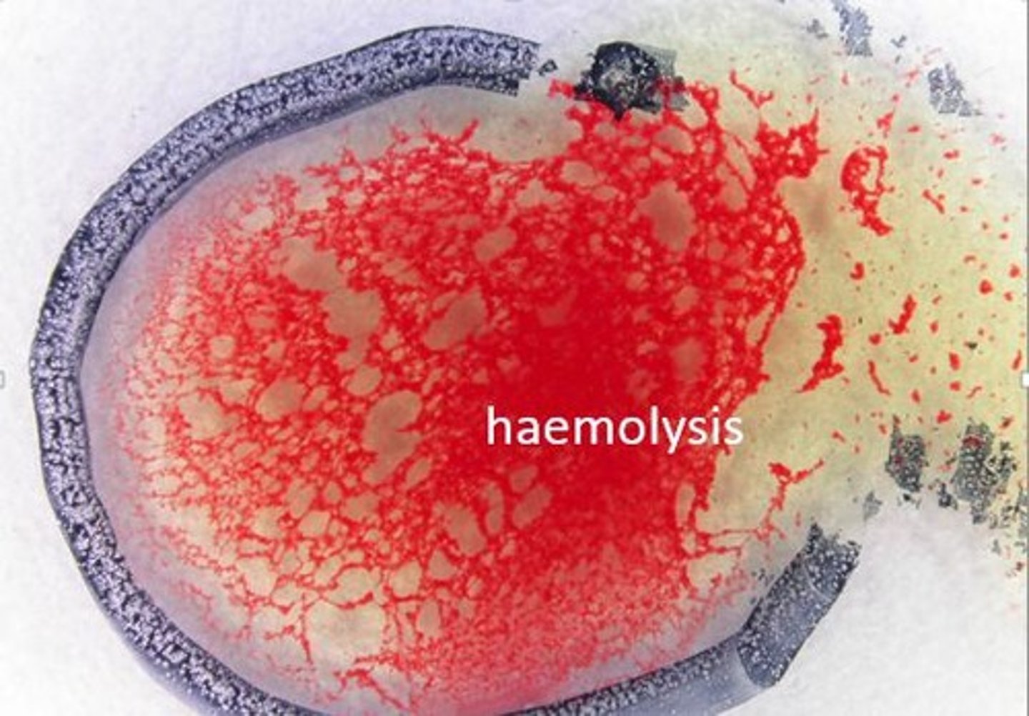 <p>Haemolysis is the rupturing of red blood cells, which can occur after agglutination, leading to the release of hemoglobin into plasma and potential kidney obstruction.</p>