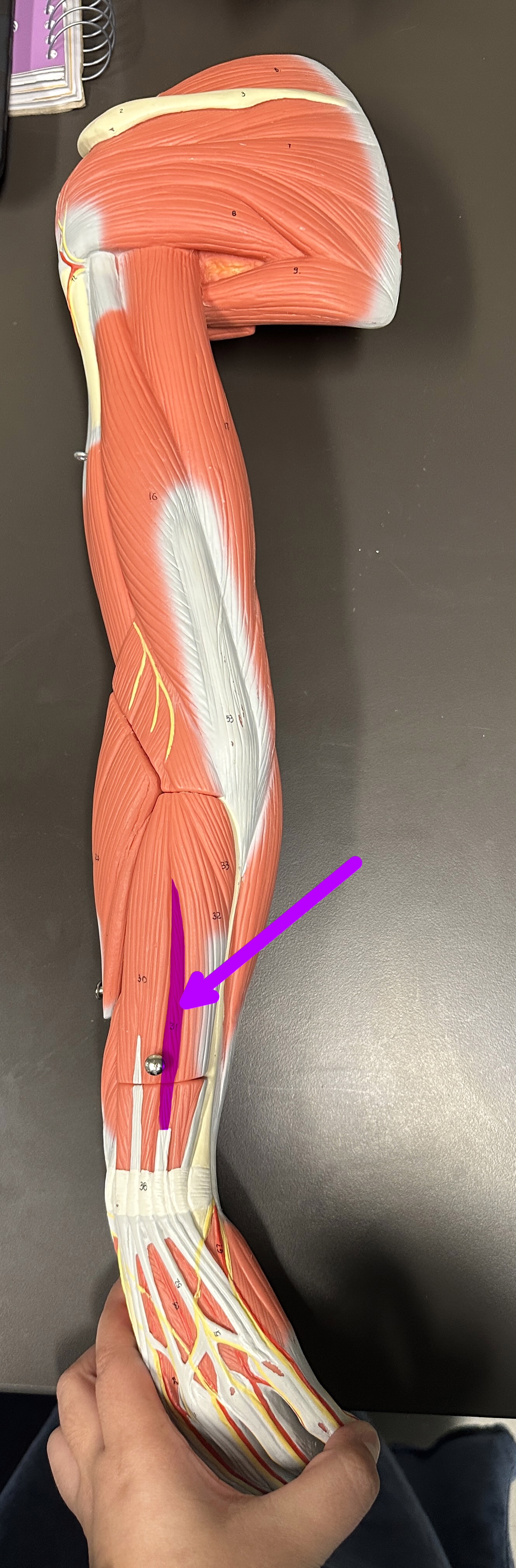 <p>What is the highlighted structure</p>