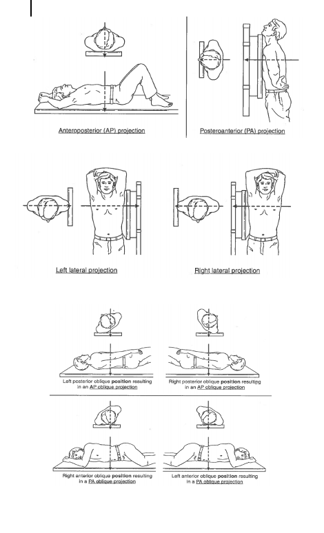 <p><span>La </span><strong><span>projection&nbsp;</span></strong><span>c’est le trajet du faisceau de rayons-X qui part du tube de rayons-X, traverse le patient et atteint le récepteur. </span><strong><span>Donc, la position (angle de projection) va aussi influencer sa densité radiographique.</span></strong></p><p><span>Type de projection : </span></p><p><span>1) Antéro-post</span></p><p><span>2) Latéral</span></p><p><span>3) Oblique</span></p>