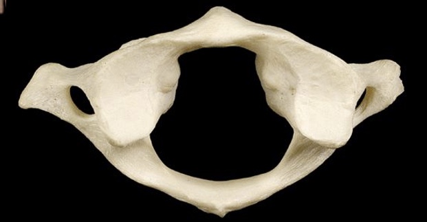 <p>What vertebrae is this?</p>