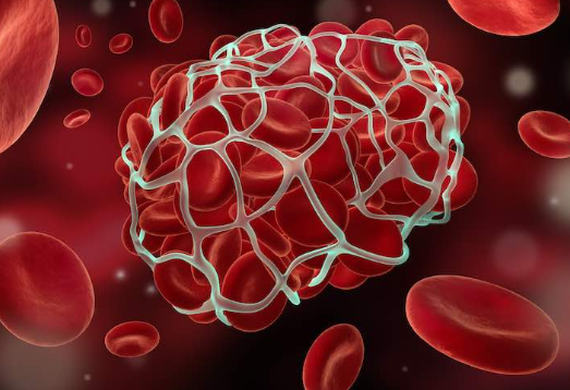<p>Go through the steps of the blood clotting process. </p>