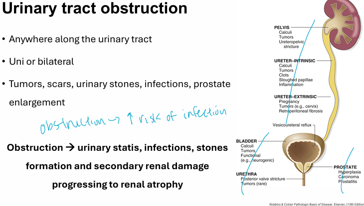 <p><span style="color: yellow"><strong>obstructions→ progress to renal atrophy<br></strong></span></p><p>Ex. of obstructions<br>- urinary statis (can’t empty urine properly)<br>- infections<br>- stone formation</p>